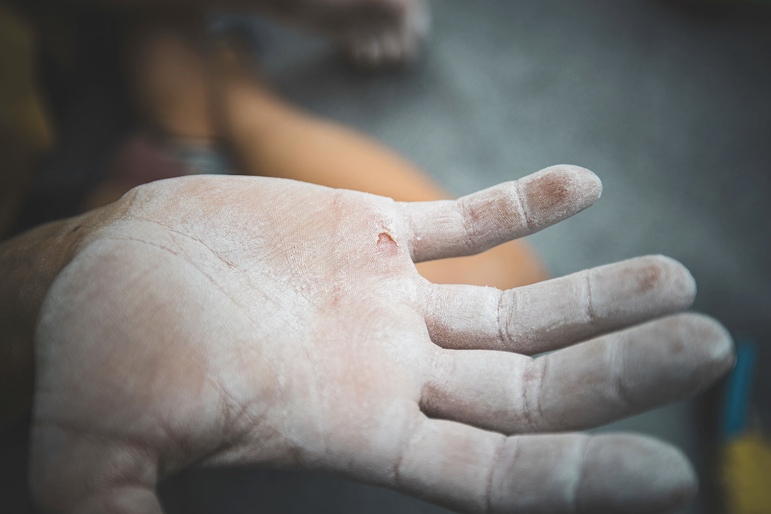 Escalade et Plaies aux Doigts : Le Guide Complet pour Soigner et Prévenir